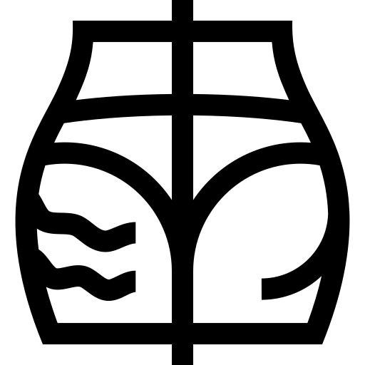 Celulitis